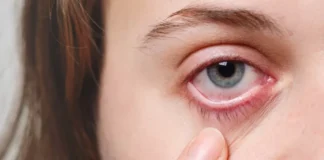 Kedutan di Mata: Mitos, Fakta, dan Kapan Harus ke Dokter